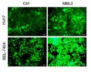 Fluorescence was used to show the transfection efficiency of lentiviruses carrying the MBL2.jpg